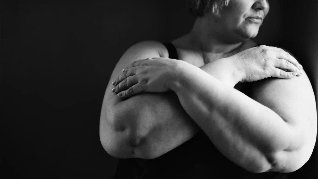 A woman with obesity crosses her arms in front of her chest