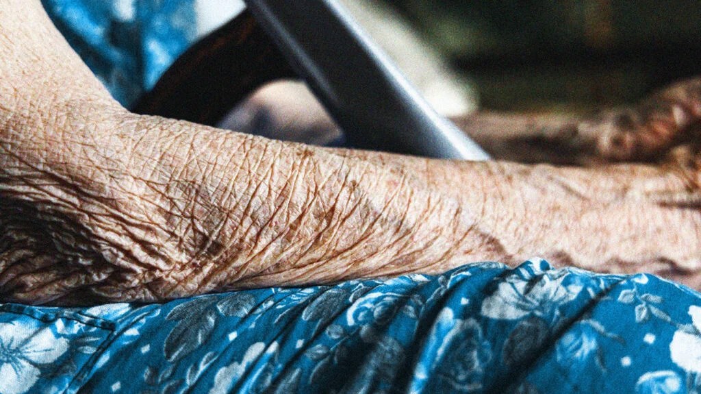 close-up of older person's wrinkled forearm